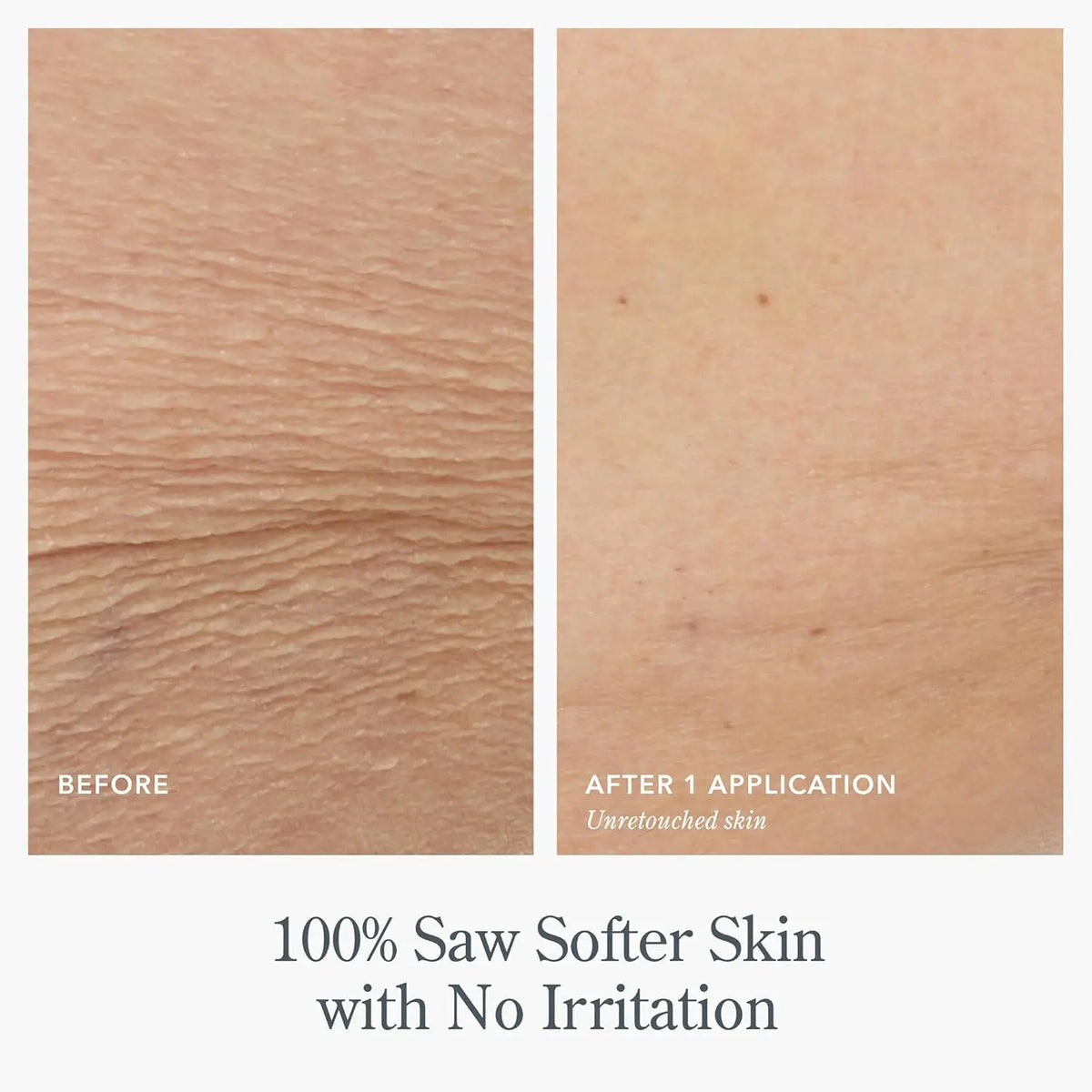 Japanese Whitening Cream 500ml Private Parts Underarm Butt Knee Brighten Inner Thigh Intimate Area Dark Remove Melanin Lighten by PETAL & GLOW
