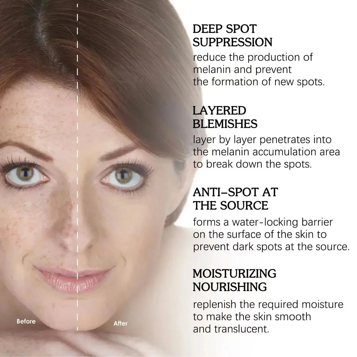 Whitening Freckles Face Cream Removal Melasma Dark Spots Corrector Lighten Melanin Pigmentation Brighten Anti-Aging Beauty Care by PETAL & GLOW