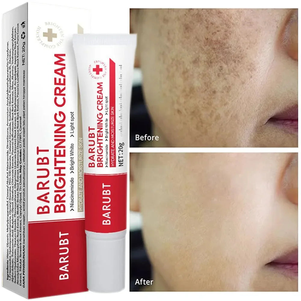 Whitening Freckles Face Cream Removal Melasma Dark Spots Corrector Lighten Melanin Pigmentation Brighten Anti-Aging Beauty Care by PETAL & GLOW