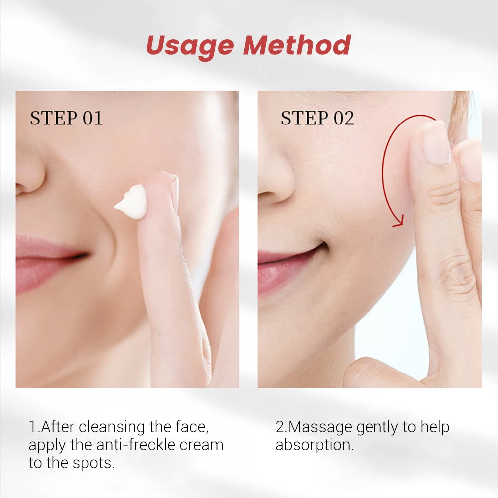 20g Whitening Freckle Cream Remove Dark Spot Cream Anti Freckle and Aging Cream Fade Pigmentation Melasma Brighten Serum Skin by PETAL & GLOW