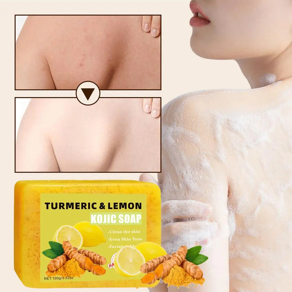 1/2PCs Lemon Turmeric Kojic Acid Soap Bar, Turmeric Soap Bar Brighten Even Skin Vitamin E, Gentle Lemon Soap For Face, Body Wash