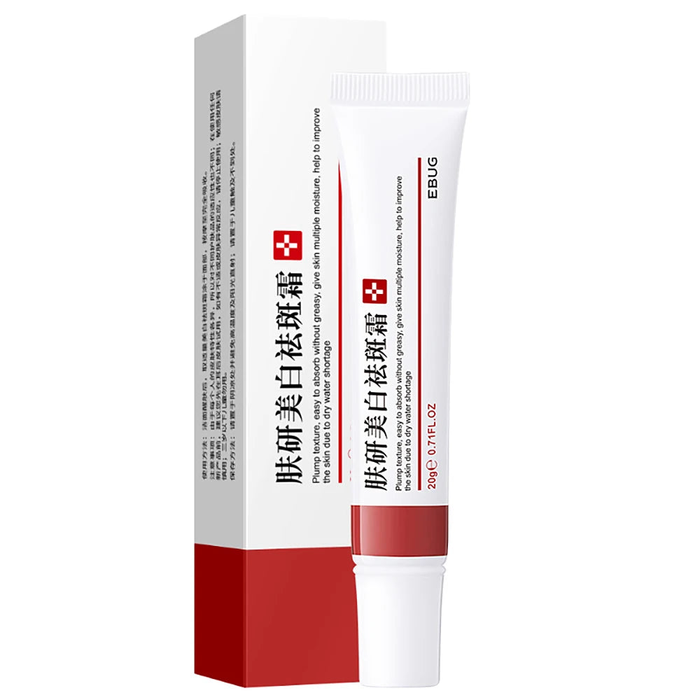 20g Whitening Freckle Cream Remove Dark Spot Cream Anti Freckle and Aging Cream Fade Pigmentation Melasma Brighten Serum Skin by PETAL & GLOW