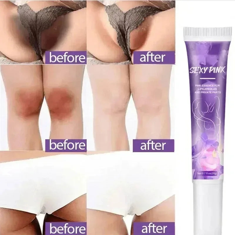 Whitening Cream Private Parts Underarm Bleaching Whiten Butt Knee Brighten Inner Thigh Intimate Parts Dark Remove Melanin by PETAL & GLOW