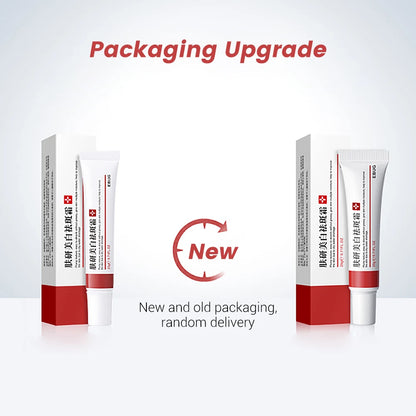 20g Whitening Freckle Cream Remove Dark Spot Cream Anti Freckle and Aging Cream Fade Pigmentation Melasma Brighten Serum Skin by PETAL & GLOW