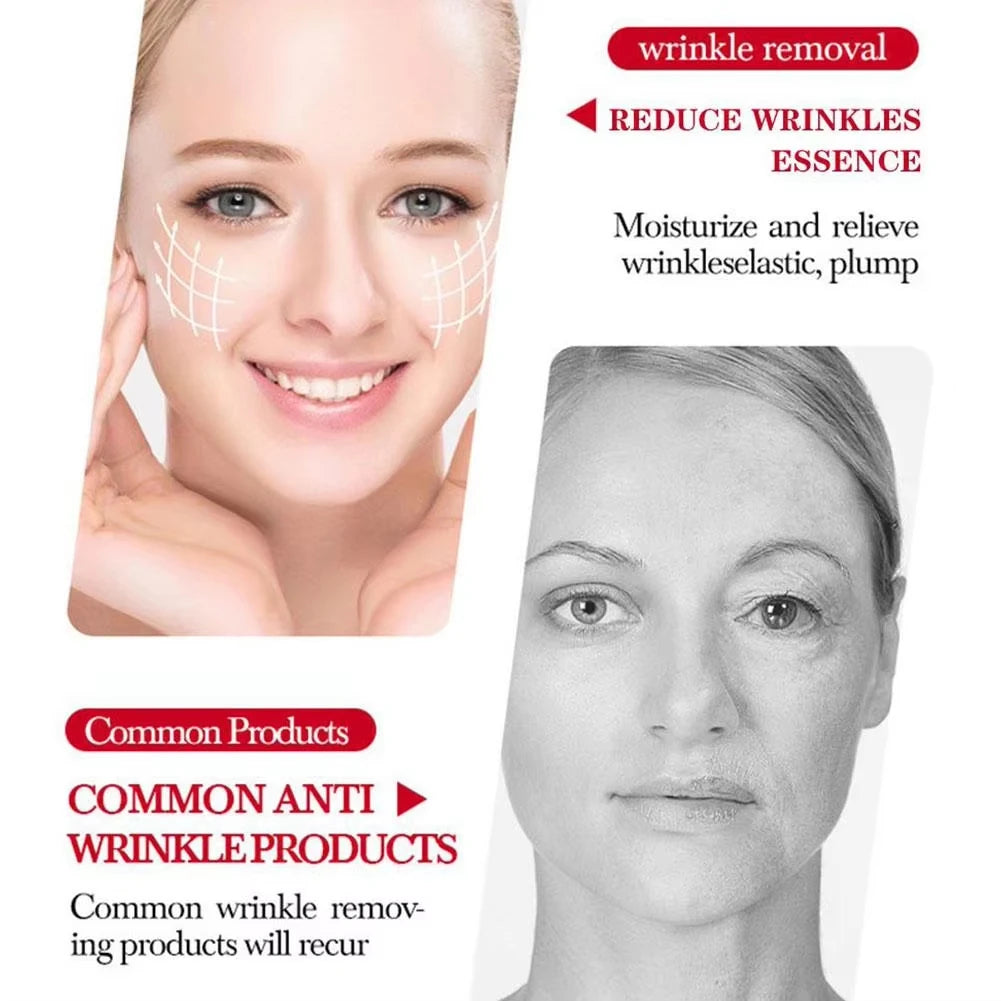 PDRN Stem Cell Anti-Aging Serum — Collagen Ampoule 30ml