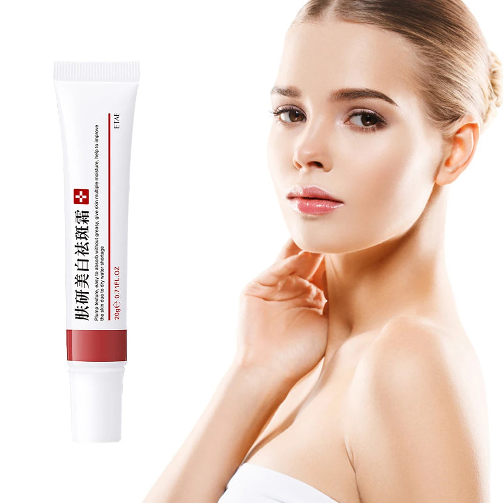 20g Whitening Freckle Cream Remove Dark Spot Cream Anti Freckle and Aging Cream Fade Pigmentation Melasma Brighten Serum Skin by PETAL & GLOW