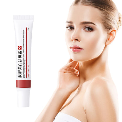 20g Whitening Freckle Cream Remove Dark Spot Cream Anti Freckle and Aging Cream Fade Pigmentation Melasma Brighten Serum Skin by PETAL & GLOW