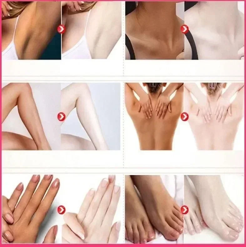 Whitening Cream Private Parts Underarm Bleaching Whiten Butt Knee Brighten Inner Thigh Intimate Parts Dark Remove Melanin by PETAL & GLOW