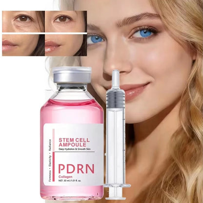 PDRN Stem Cell Anti-Aging Serum — Collagen Ampoule 30ml